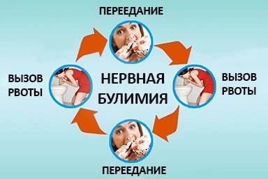 Лечение булимии в Краснокамске